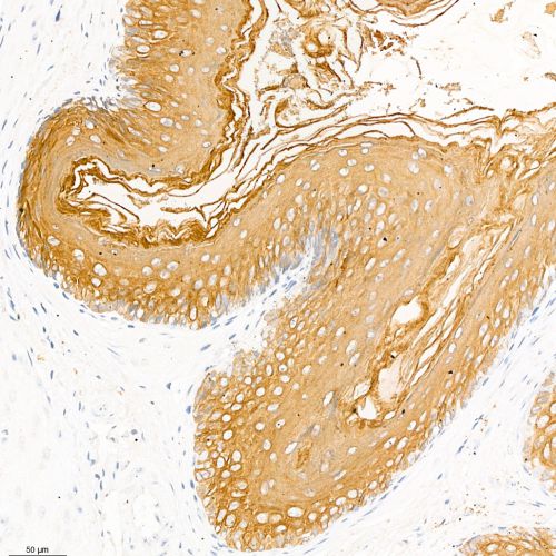 Anti -Cytokeratin 10 Rabbit pAb