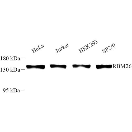 Anti -RBM26 Rabbit pAb